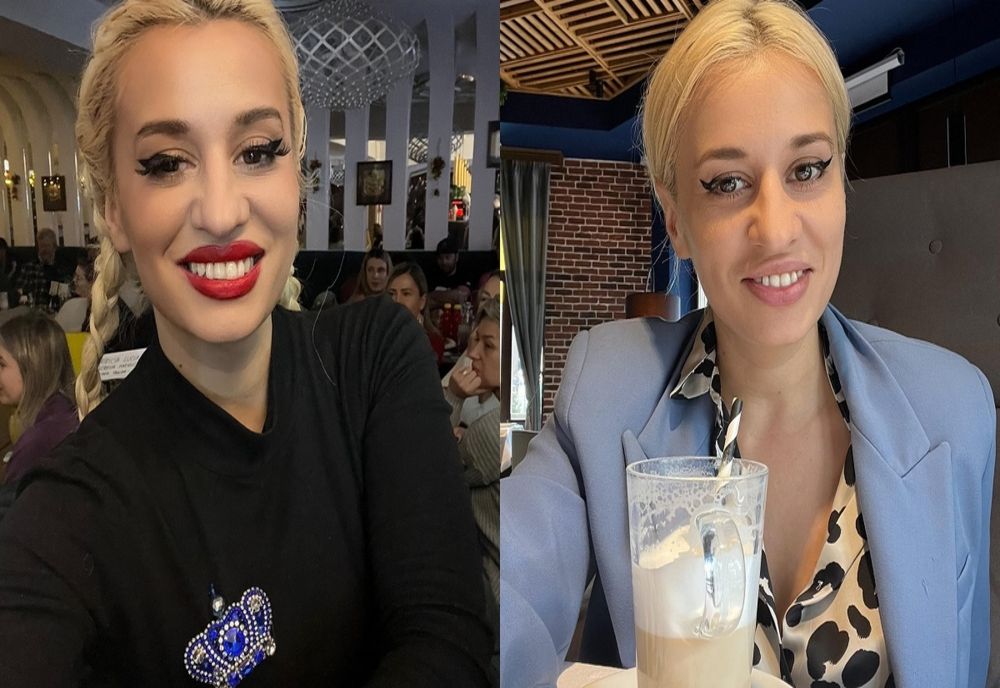 Cum arată Anisia Gafton după ce și-a operat nasul