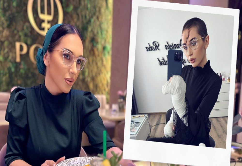 Suma colosală pe care Dana Roba trebuie să o plătească pentru operația de reconstrucție a craniului: „Era să mi se facă rău când am auzit”