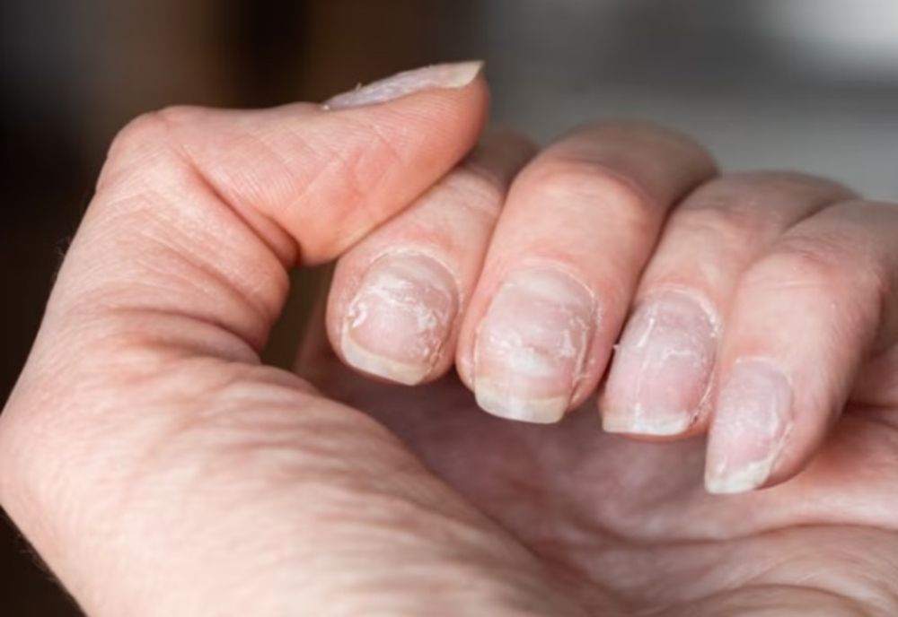 UNGHII MOI ȘI CASANTE: IATĂ CUM LE POȚI REPARA DUPĂ ÎNDEPĂRTAREA GELULUI SAU A OJEI SEMIPARMANENTE!