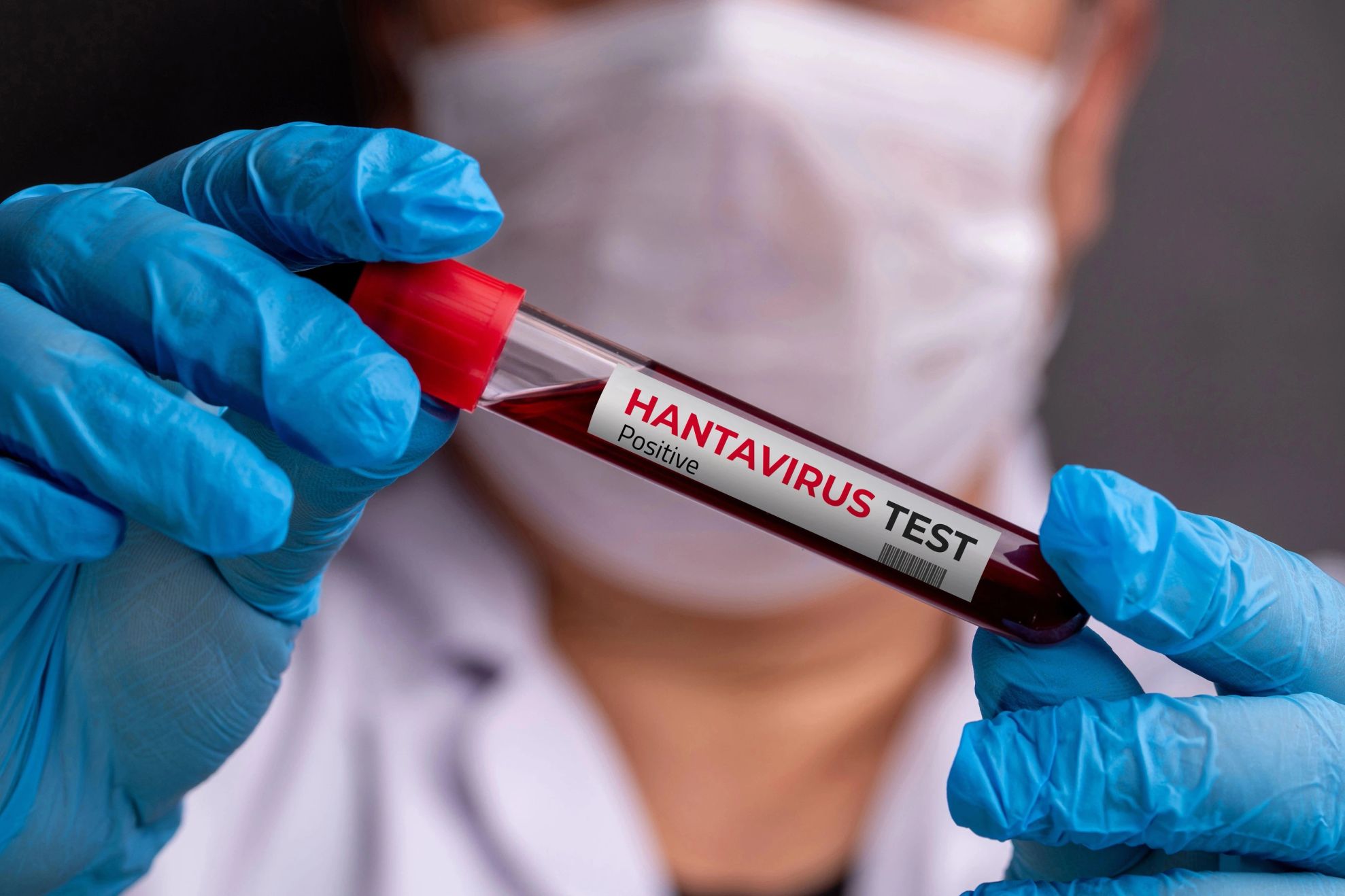 hantavirus